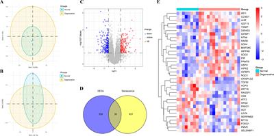 Identification of cellular senescence-related genes and immune cell infiltration characteristics in intervertebral disc degeneration